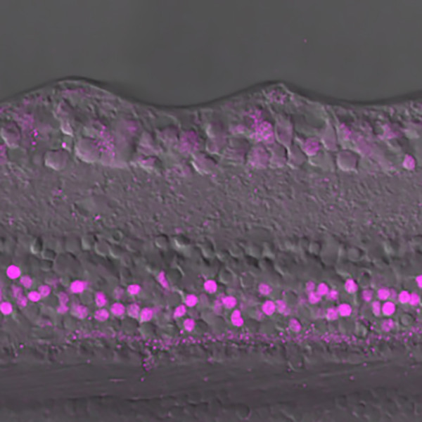 Nuclei of ON cone bipolar cells in human retina labeled with DSHB antibody 39.3F7 anti-Islet-1 specific homeobox (magenta). PMID: 34259817, Fig. 4E.